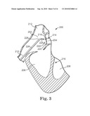 SYSTEM AND METHOD FOR CATHETER-BASED SEPTAL DEFECT REPAIR diagram and image