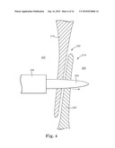 SYSTEM AND METHOD FOR CATHETER-BASED SEPTAL DEFECT REPAIR diagram and image