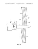 SYSTEM AND METHOD FOR CATHETER-BASED SEPTAL DEFECT REPAIR diagram and image