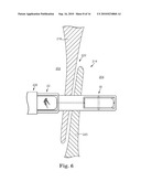 SYSTEM AND METHOD FOR CATHETER-BASED SEPTAL DEFECT REPAIR diagram and image