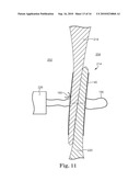 SYSTEM AND METHOD FOR CATHETER-BASED SEPTAL DEFECT REPAIR diagram and image