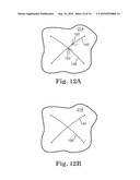 SYSTEM AND METHOD FOR CATHETER-BASED SEPTAL DEFECT REPAIR diagram and image