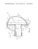 SYSTEM AND METHOD FOR CATHETER-BASED SEPTAL DEFECT REPAIR diagram and image