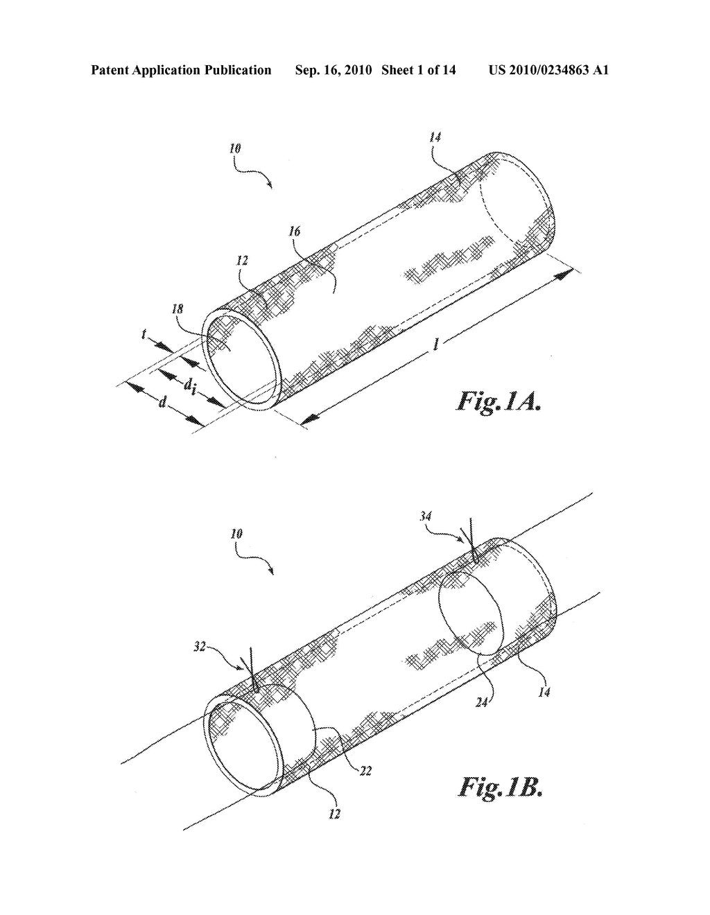 NANOFIBROUS CONDUITS FOR NERVE REGENERATION - diagram, schematic, and image 02