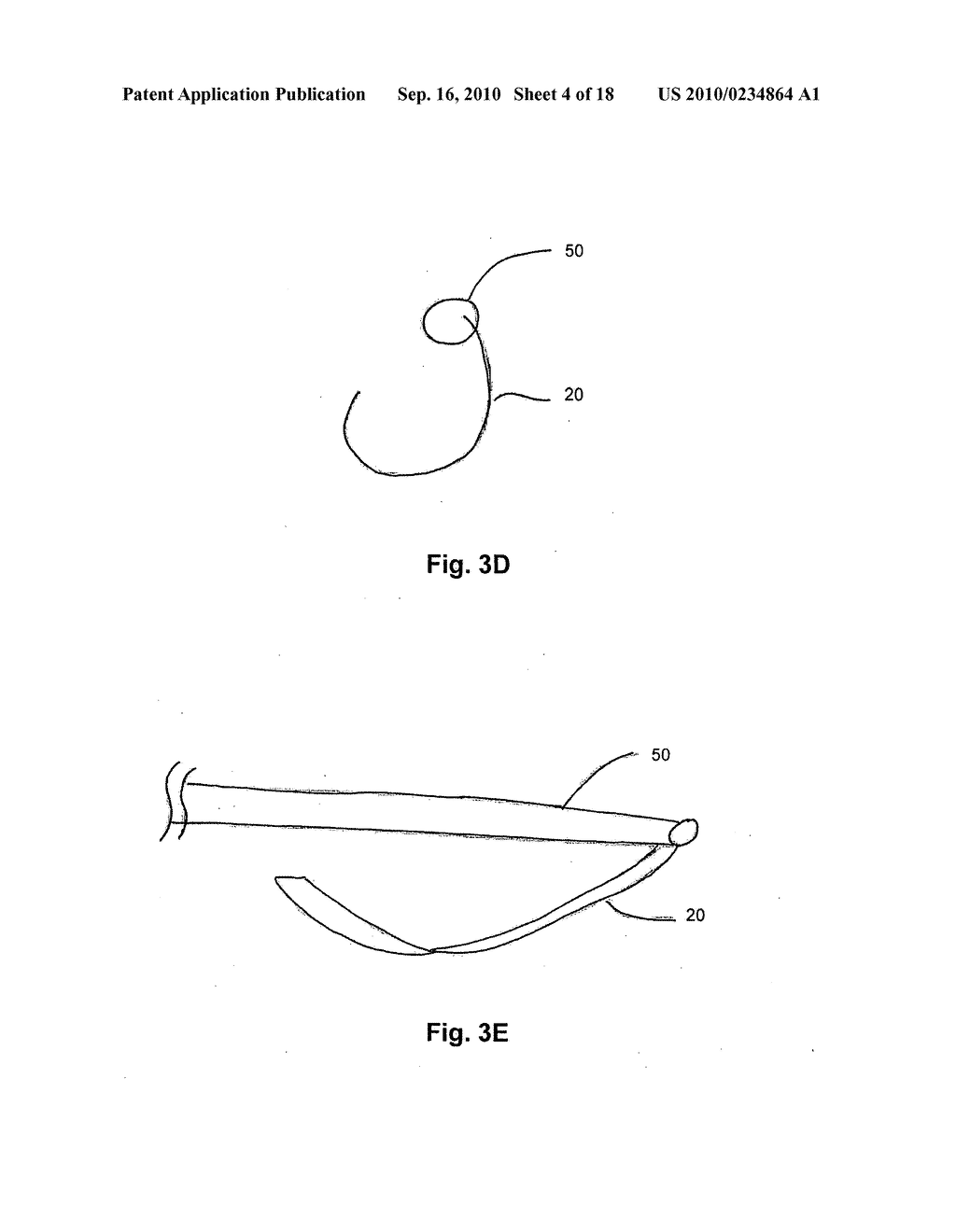 Three-Dimensional Cutting Instrument - diagram, schematic, and image 05