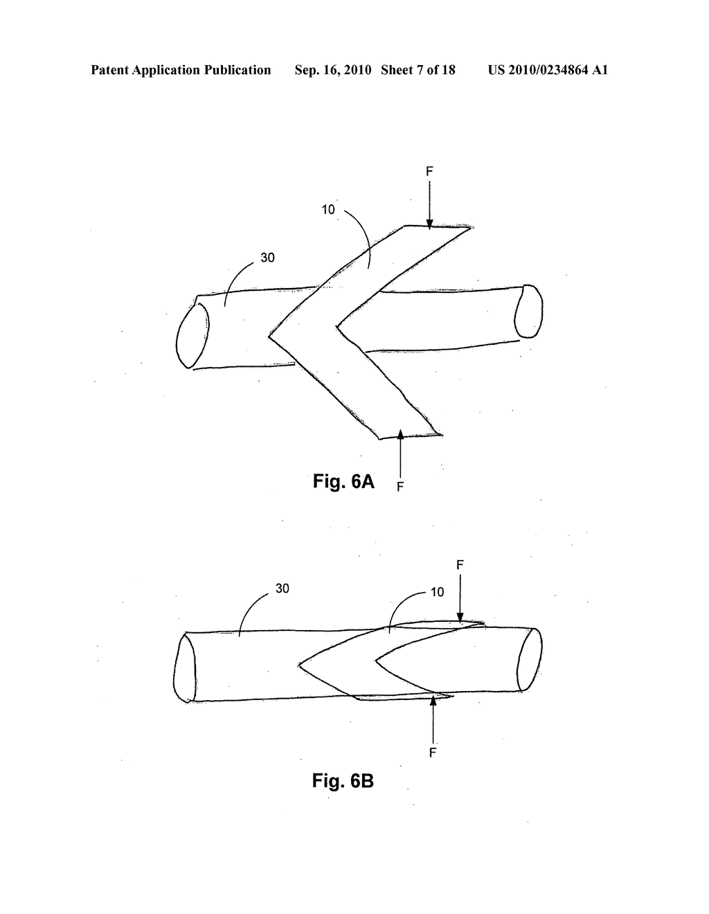 Three-Dimensional Cutting Instrument - diagram, schematic, and image 08