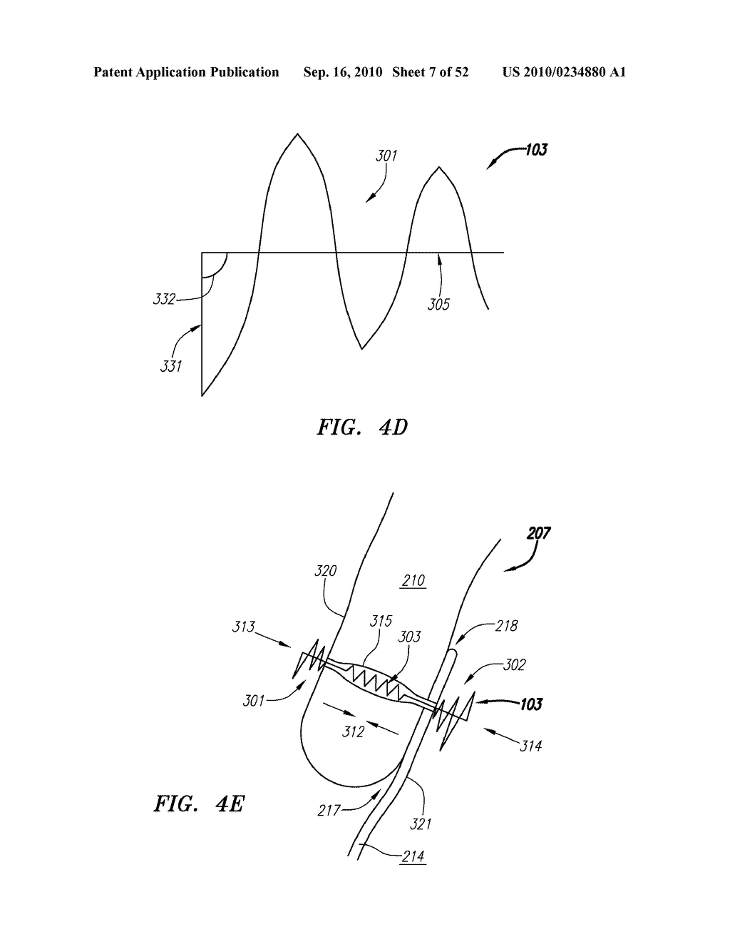 Systems and Methods for Treating Septal Defects - diagram, schematic, and image 08