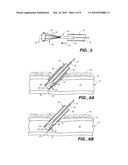 CLOSURE DEVICE WITH TEXTURED SURFACE diagram and image