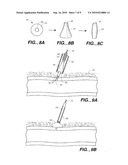 CLOSURE DEVICE WITH TEXTURED SURFACE diagram and image