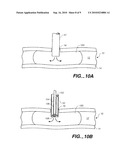 CLOSURE DEVICE WITH TEXTURED SURFACE diagram and image