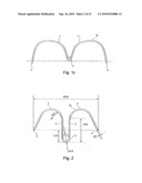 METHOD FOR SECURING MEDICAL DEVICES TO TREAT OBESITY, GASTRO-ESOPHAGEAL REFLUX DISEASE (GERD) AND IRRITABLE BOWEL SYNDROME (iBS) REVERSIBLY diagram and image