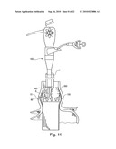 METHOD FOR SECURING MEDICAL DEVICES TO TREAT OBESITY, GASTRO-ESOPHAGEAL REFLUX DISEASE (GERD) AND IRRITABLE BOWEL SYNDROME (iBS) REVERSIBLY diagram and image