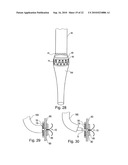 METHOD FOR SECURING MEDICAL DEVICES TO TREAT OBESITY, GASTRO-ESOPHAGEAL REFLUX DISEASE (GERD) AND IRRITABLE BOWEL SYNDROME (iBS) REVERSIBLY diagram and image