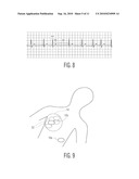 Repositionable Electrode and Systems and Methods for Identifying Electrode Position for Cardiotherapy diagram and image