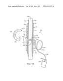 Digestive Organ Retention Device diagram and image