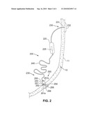 Digestive Organ Retention Device diagram and image