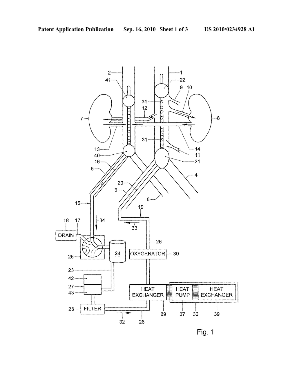 METHOD AND A SYSTEM FOR PROLONGATION OF THE VIABILITY OF A DONOR ORGAN - diagram, schematic, and image 02