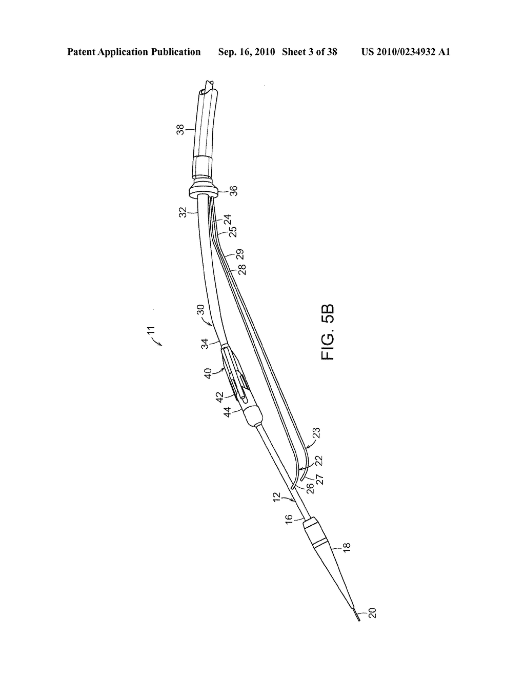 SYSTEM AND METHOD FOR DEPLOYING AN ENDOLUMINAL PROSTHESIS AT A SURGICAL SITE - diagram, schematic, and image 04