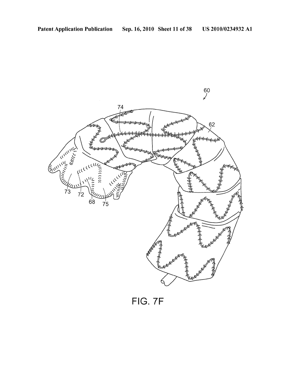 SYSTEM AND METHOD FOR DEPLOYING AN ENDOLUMINAL PROSTHESIS AT A SURGICAL SITE - diagram, schematic, and image 12