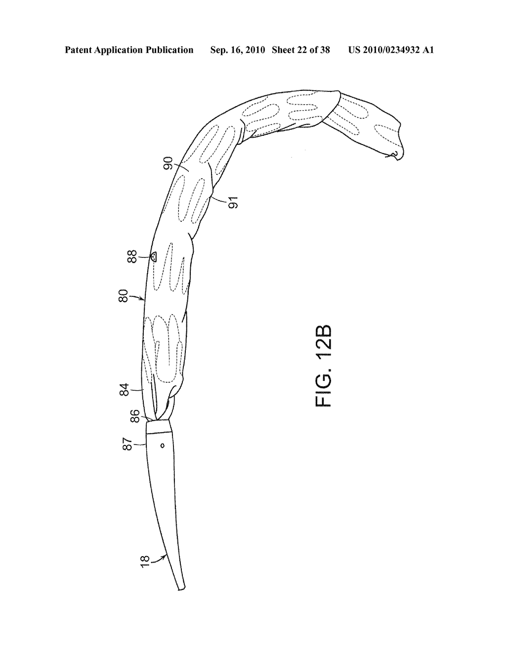 SYSTEM AND METHOD FOR DEPLOYING AN ENDOLUMINAL PROSTHESIS AT A SURGICAL SITE - diagram, schematic, and image 23