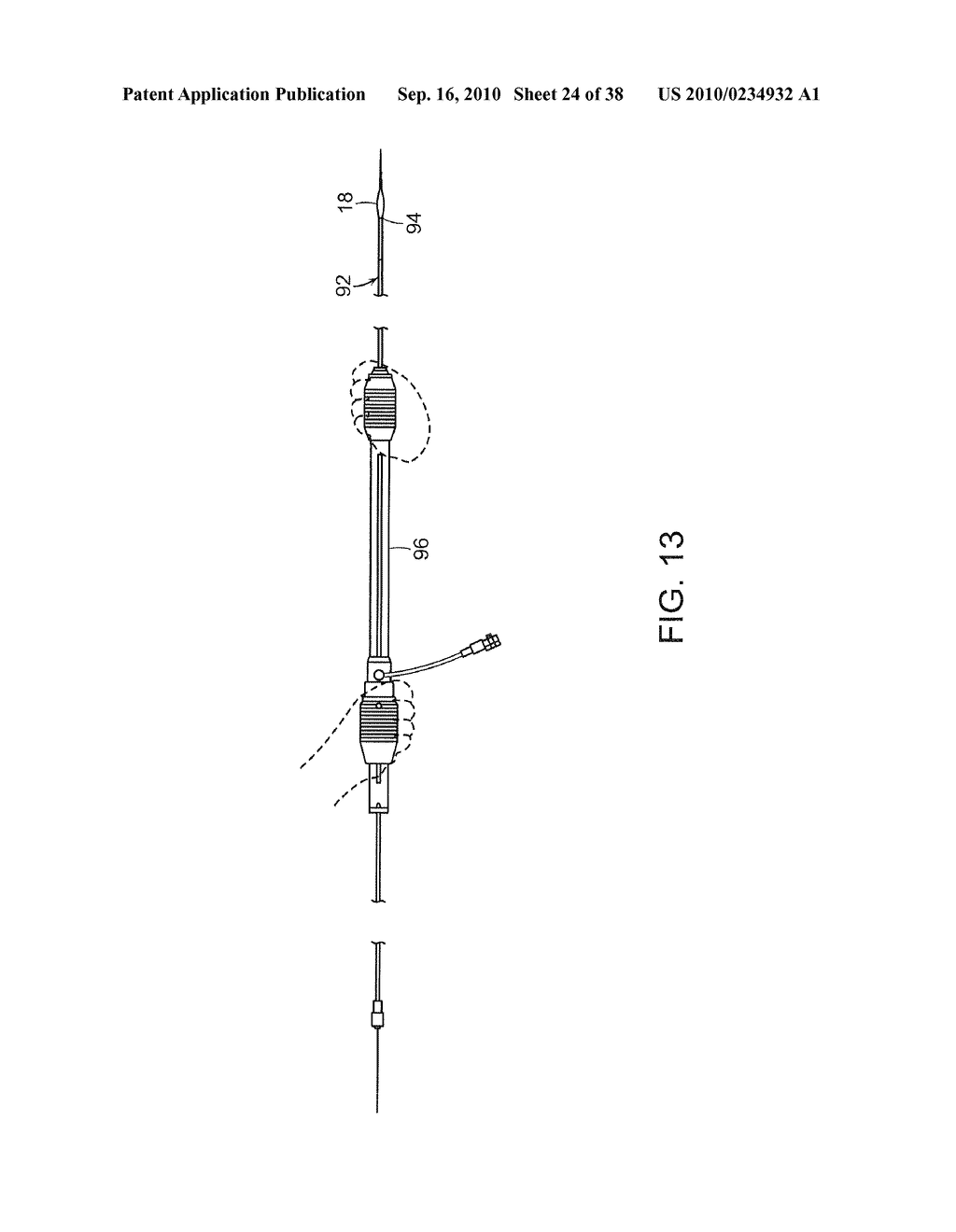 SYSTEM AND METHOD FOR DEPLOYING AN ENDOLUMINAL PROSTHESIS AT A SURGICAL SITE - diagram, schematic, and image 25