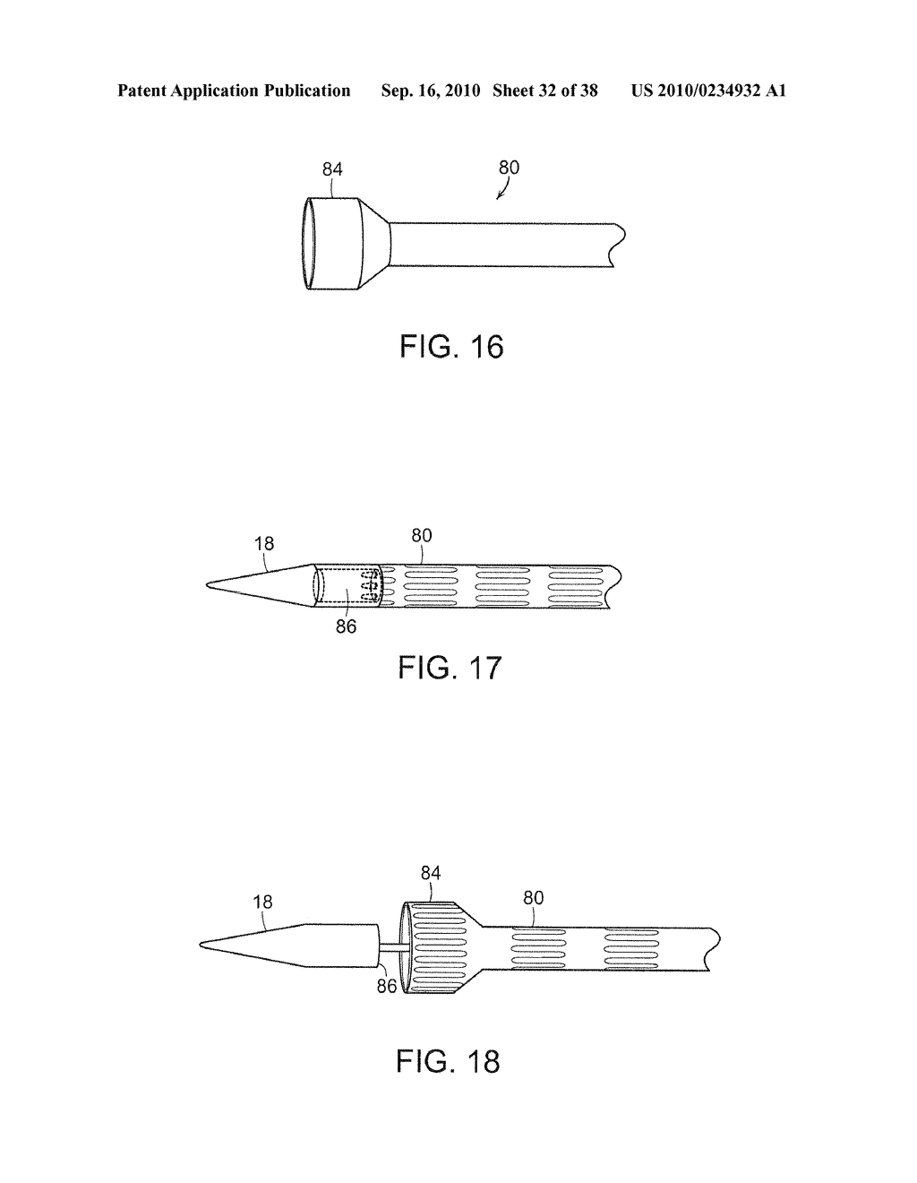 SYSTEM AND METHOD FOR DEPLOYING AN ENDOLUMINAL PROSTHESIS AT A SURGICAL SITE - diagram, schematic, and image 33