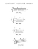 SYSTEM AND METHOD FOR DEPLOYING AN ENDOLUMINAL PROSTHESIS AT A SURGICAL SITE diagram and image