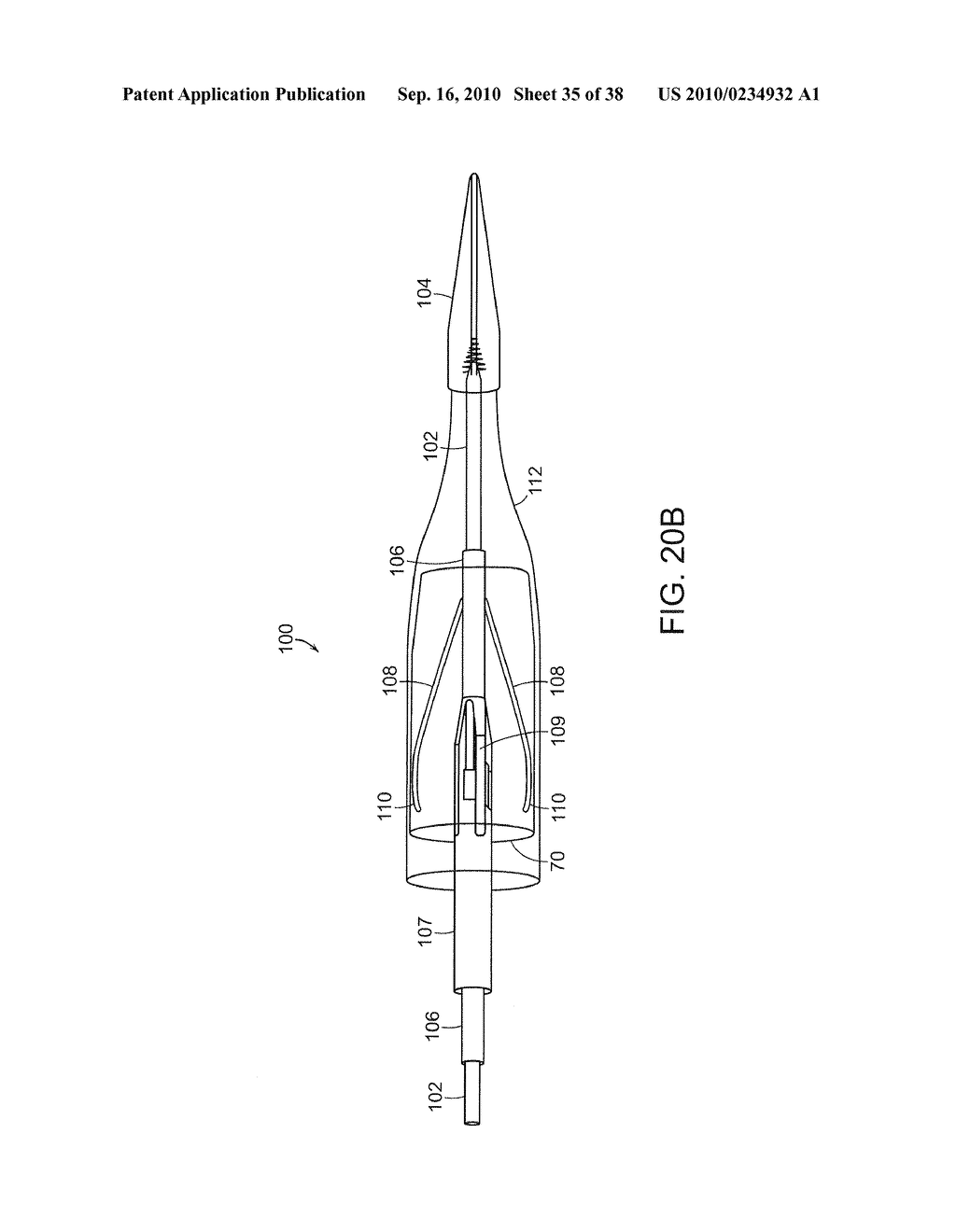 SYSTEM AND METHOD FOR DEPLOYING AN ENDOLUMINAL PROSTHESIS AT A SURGICAL SITE - diagram, schematic, and image 36