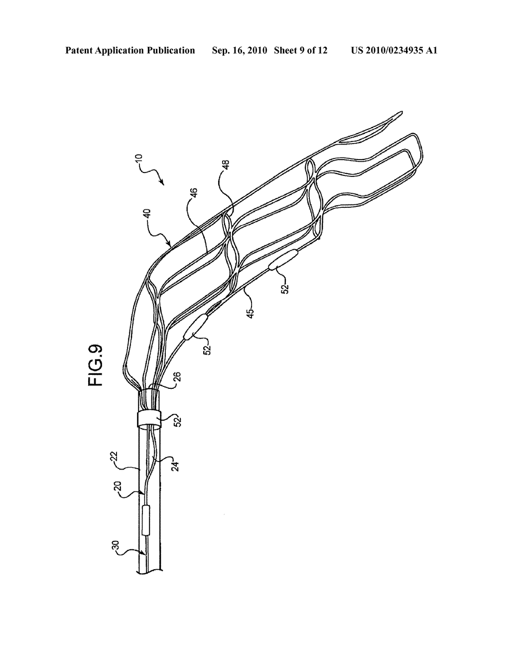 Detachable And Retrievable Stent Assembly - diagram, schematic, and image 10