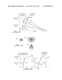 NON-PROLATE ASPHERIC INTRAOCULAR LENS diagram and image