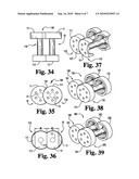 Osteogenic fusion device diagram and image