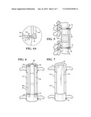 COMBINATION SPACER INSERT AND SUPPORT FOR PROVIDING INTER-CERVICAL VERTEBRAL SUPPORT diagram and image