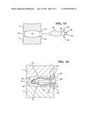 COMBINATION SPACER INSERT AND SUPPORT FOR PROVIDING INTER-CERVICAL VERTEBRAL SUPPORT diagram and image