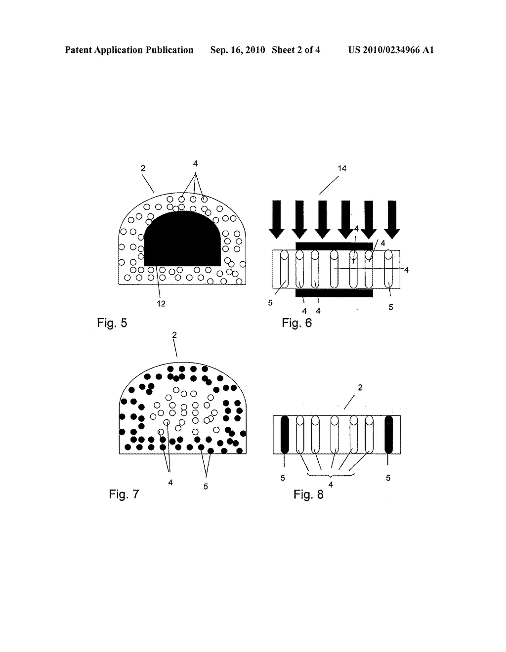 BONE REPAIR OR AUGMENTATION DEVICE - diagram, schematic, and image 03