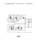 PROTECTIVE GARMENT HAVING A QUICK RELEASE SYSTEM diagram and image