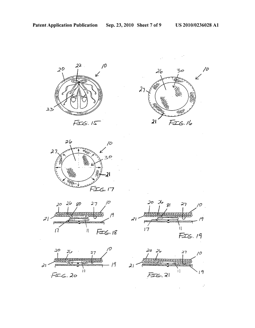 Button cover assembly and method for making same - diagram, schematic, and image 08