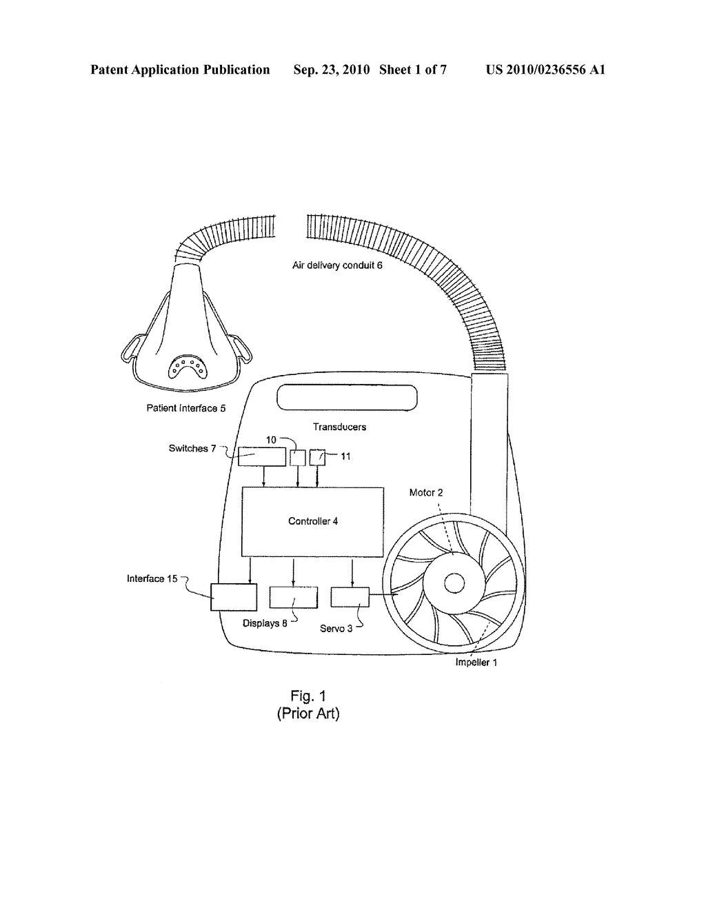 VENTILATOR PATIENT SYNCHRONIZATION - diagram, schematic, and image 02