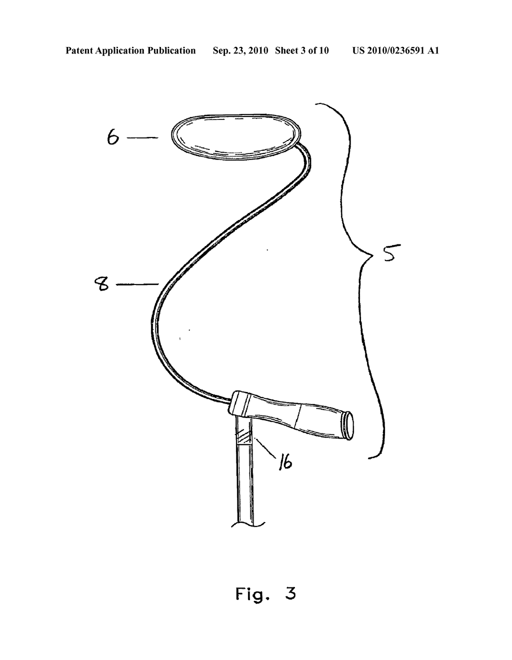 Ambulation Assistance Apparatus and Methods - diagram, schematic, and image 04