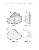 Breast Prosthesis for Patients with Edema diagram and image