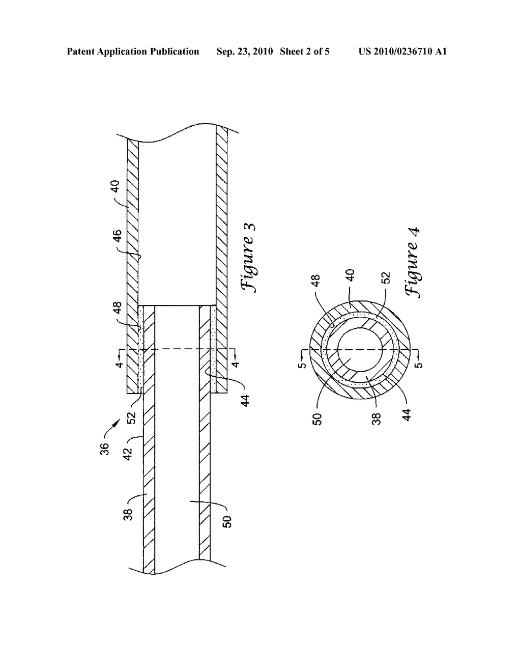 Medical Devices Including Aerated Adhesive Bonds and Methods of Forming the Same - diagram, schematic, and image 03