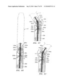 SURGICAL STAPLING APPARATUS diagram and image