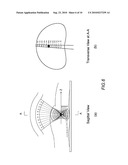 METHOD AND DEVICE FOR IMAGE GUIDED DYNAMIC RADIATION TREATMENT OF PROSTATE CANCER AND OTHER PELVIC LESIONS diagram and image