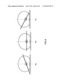 METHOD AND DEVICE FOR IMAGE GUIDED DYNAMIC RADIATION TREATMENT OF PROSTATE CANCER AND OTHER PELVIC LESIONS diagram and image