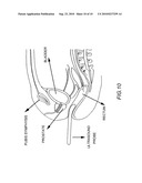 METHOD AND DEVICE FOR IMAGE GUIDED DYNAMIC RADIATION TREATMENT OF PROSTATE CANCER AND OTHER PELVIC LESIONS diagram and image