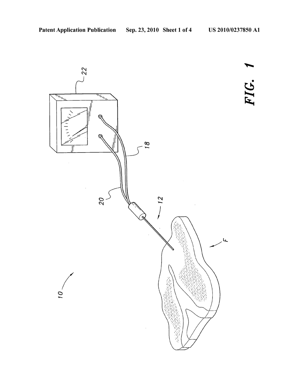 Device and method for testing food quality - diagram, schematic, and image 02