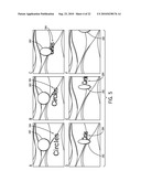 SYSTEMS, METHODS, AND DEVICES FOR FLASH EXPOSURE CONTROL USING PREFLASH STATISTICS diagram and image