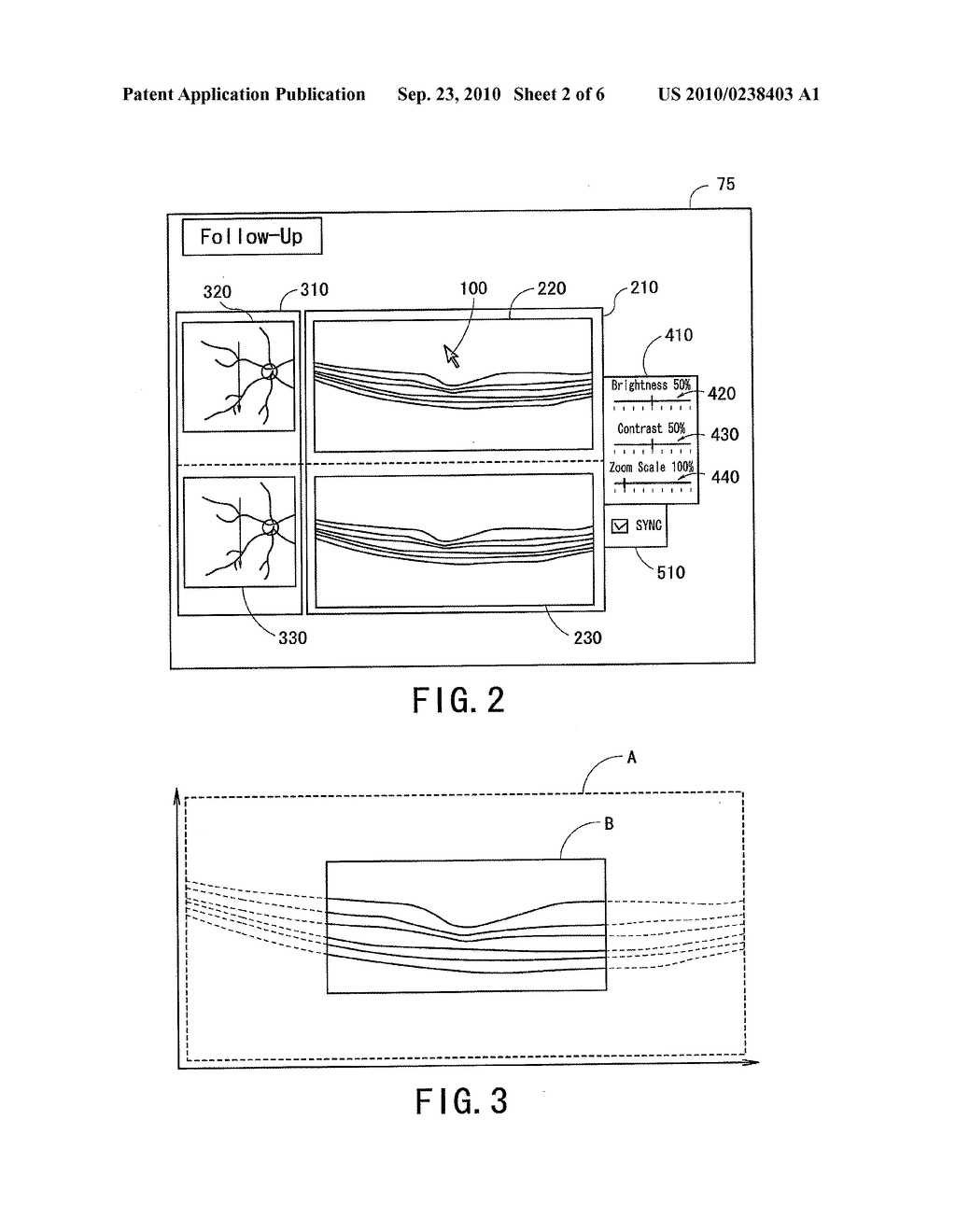 OPHTHALMIC OBSERVATION APPARATUS AND OPHTHALMIC OBSERVATION PROGRAM - diagram, schematic, and image 03