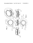 SURGICAL MICROSCOPE DRAPE LENS FOR REDUCING GLARE diagram and image