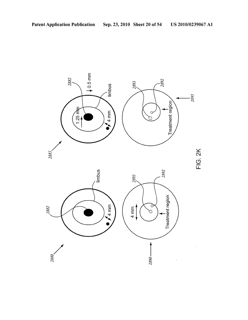 ORTHOVOLTAGE RADIOSURGERY - diagram, schematic, and image 21