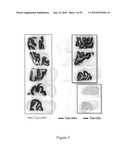 Imaging agents for detecting neurological disorders diagram and image